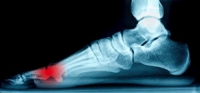 The Location of the Sesamoid Bones